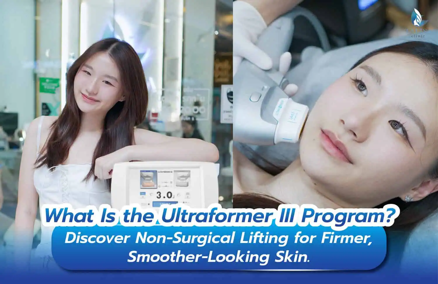 Ultraformer III HIFU treatment banner for non-surgical skin tightening and face lifting
