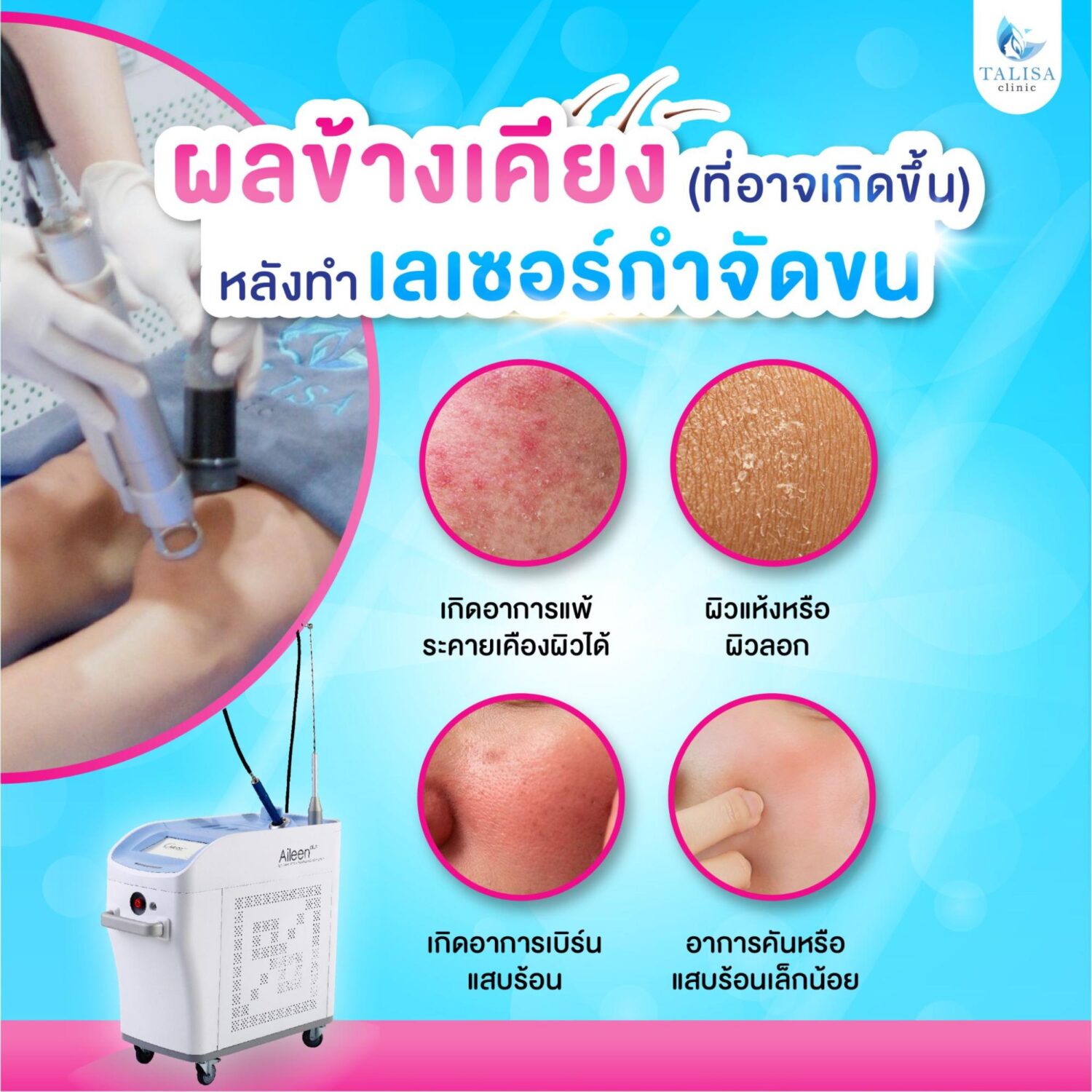 ผลข้างเคียงการเลเซอร์ขน