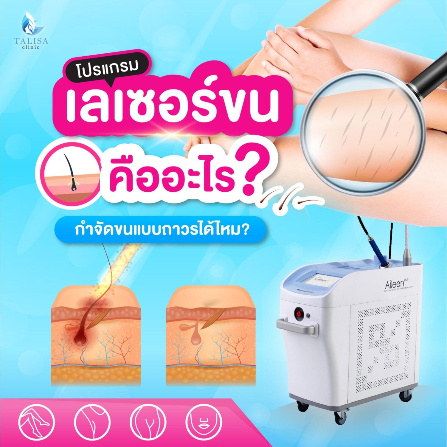 ข้อดีการเลเซอร์ขน