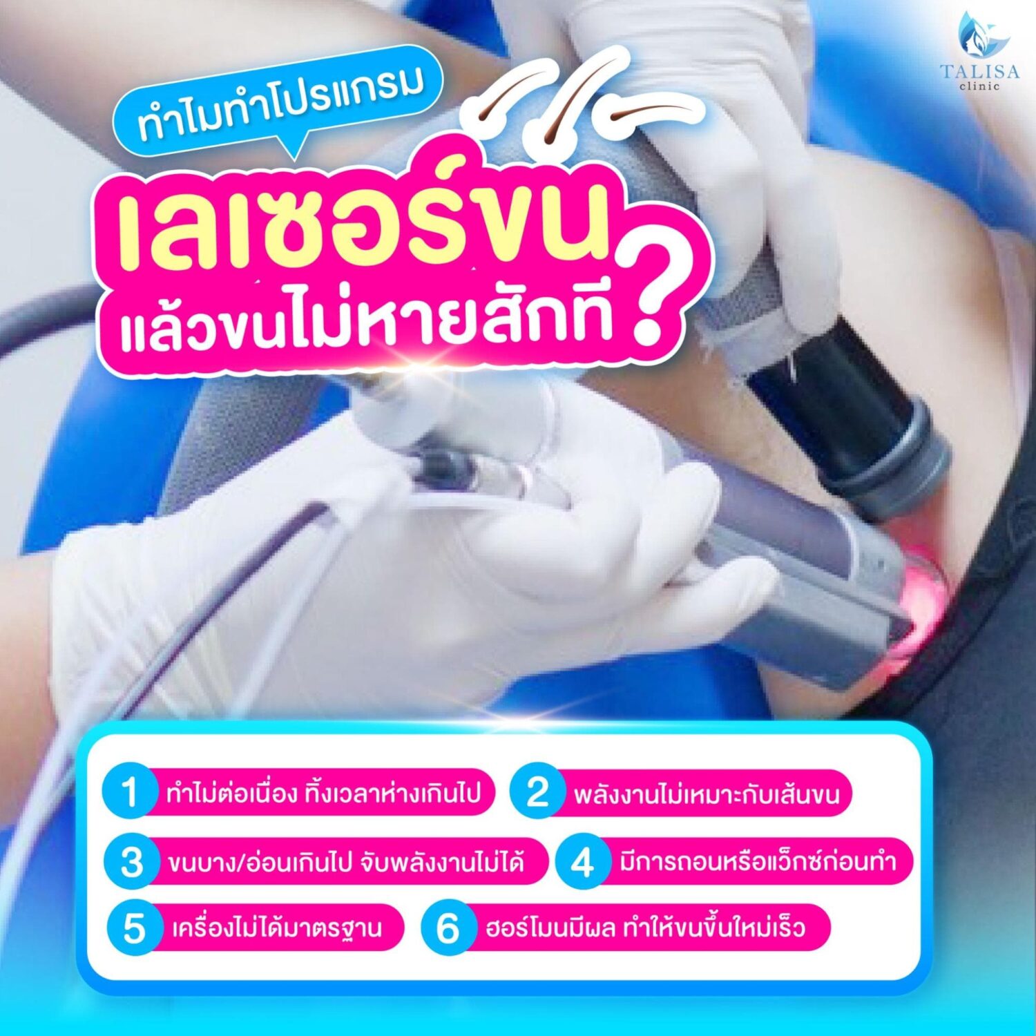 ทําไมเลเซอร์ขนแล้วขนไม่หาย