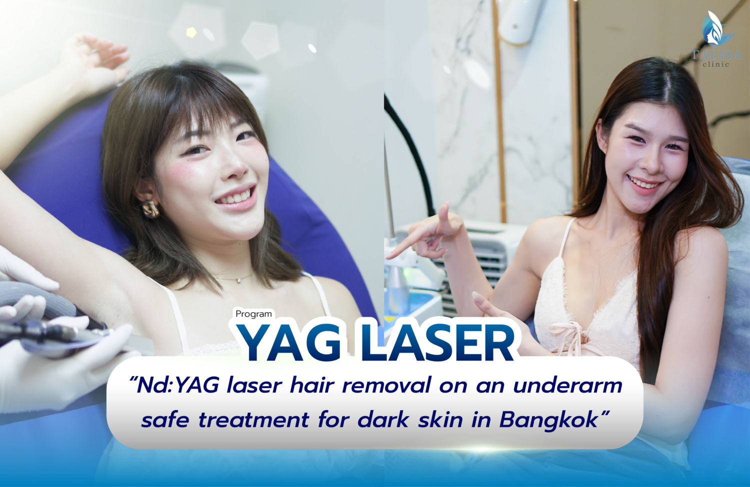 Nd:YAG laser hair removal on an underarm, safe treatment for dark skin in Bangkok