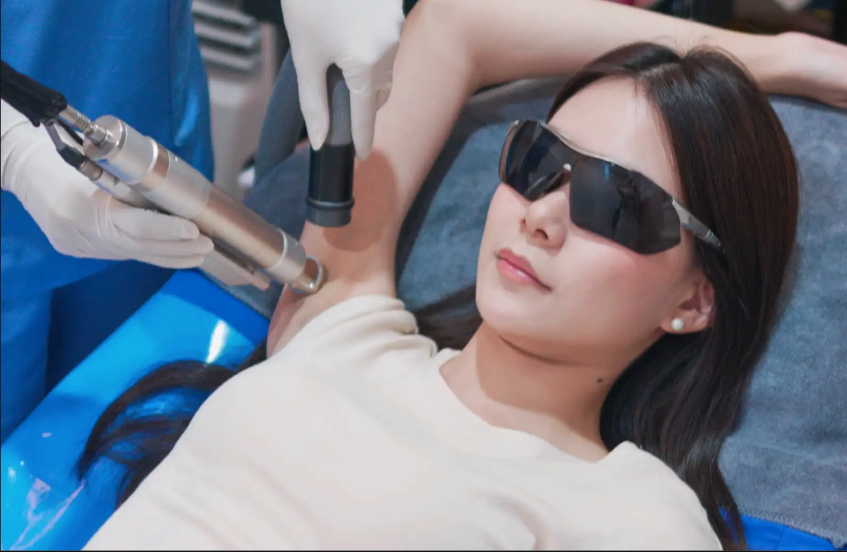 armpit YAG laser hair removal for Asian skin at a Bangkok clinic