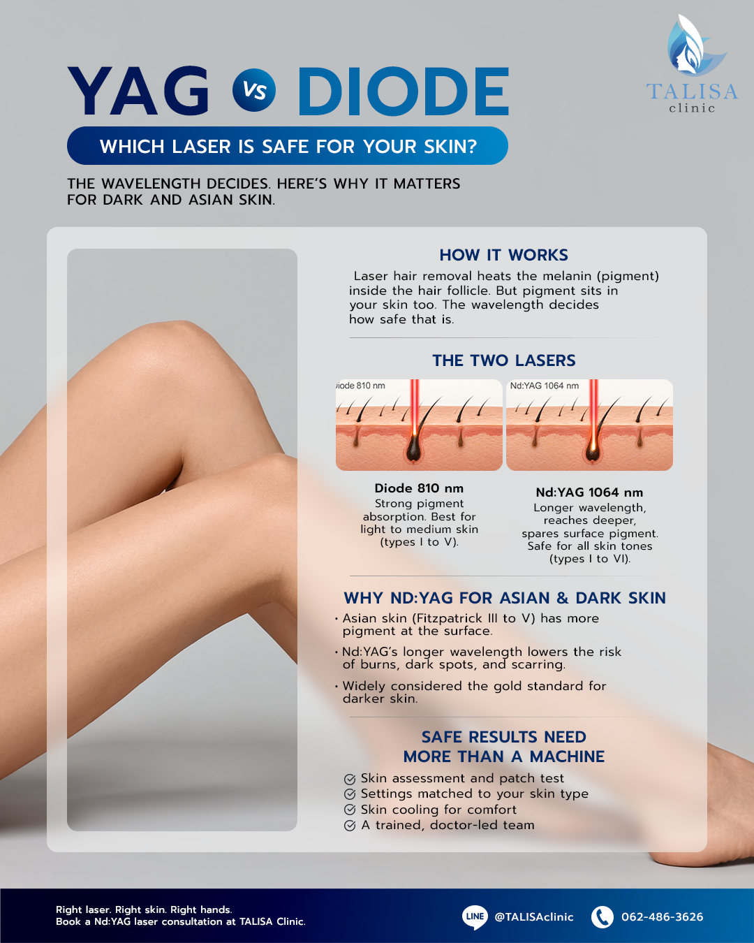Infographic comparing Nd:YAG vs diode laser hair removal safety for dark and Asian skin