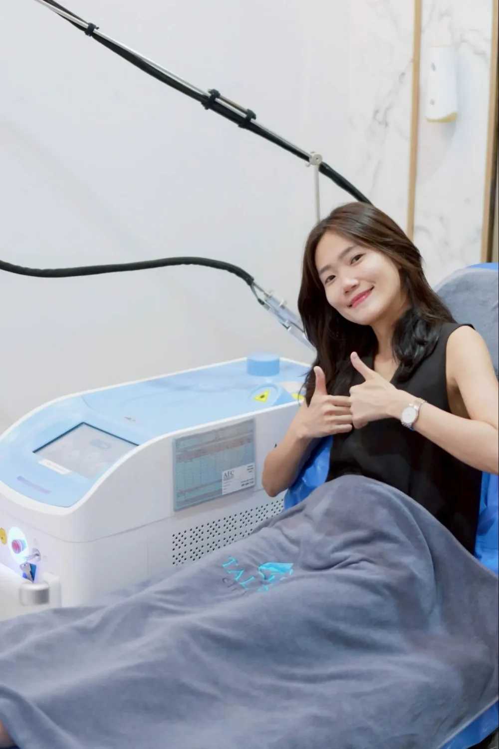 Yag Laser หนวด