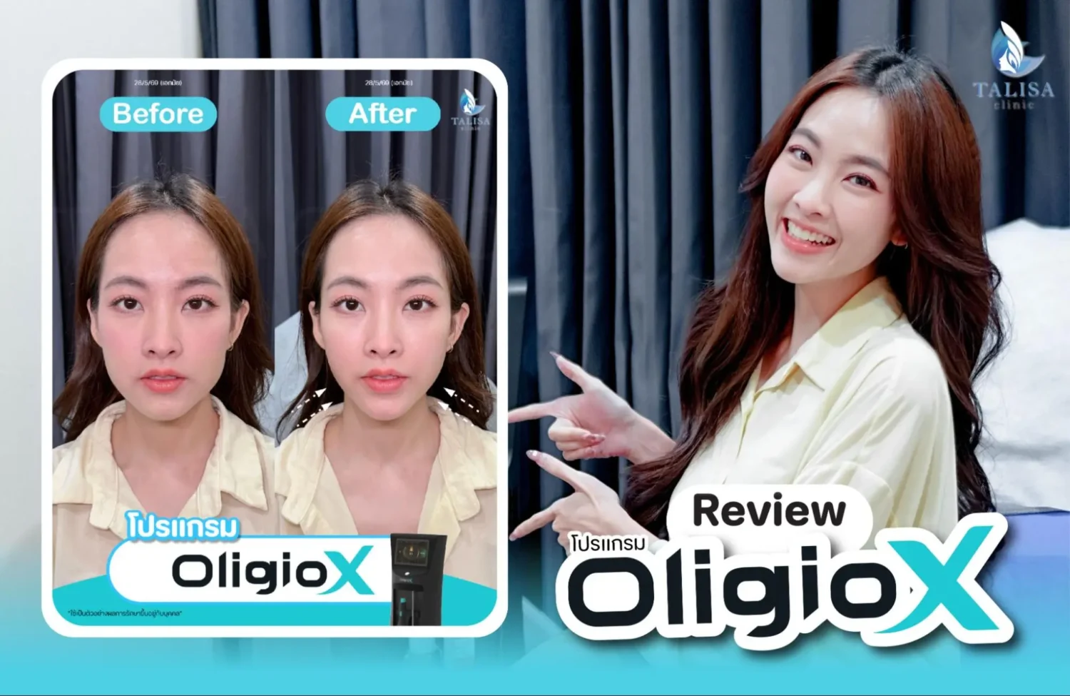 Oligio X รีวิว