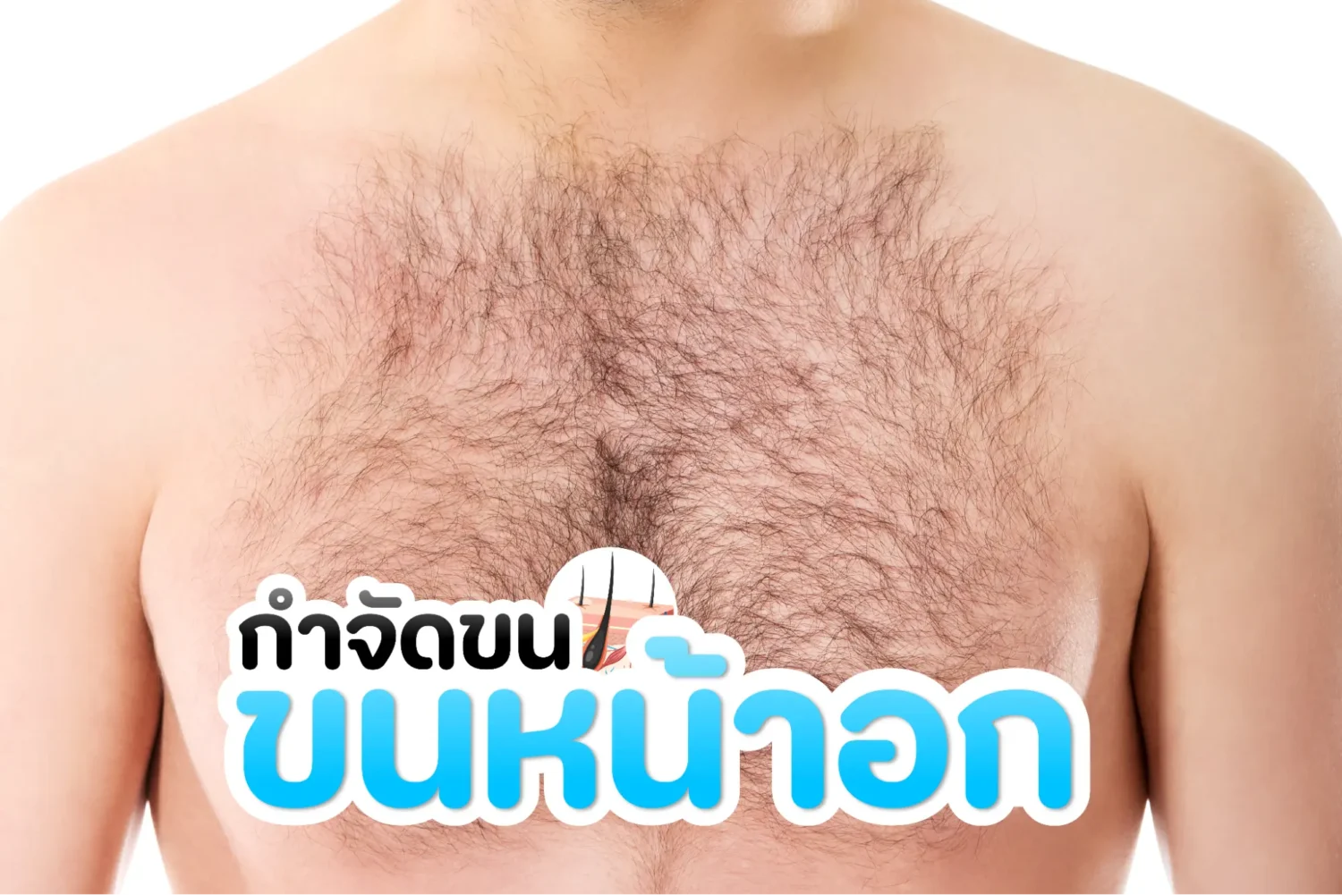 ขนหน้าอกเยอะ