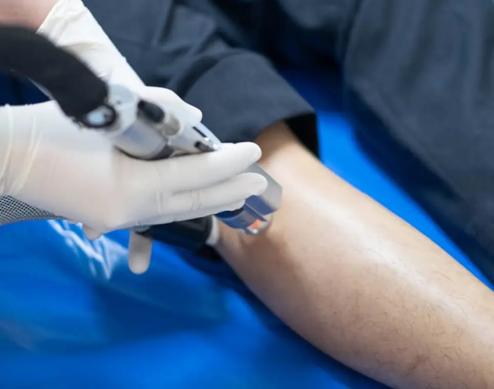 เครื่องกำจัดขน