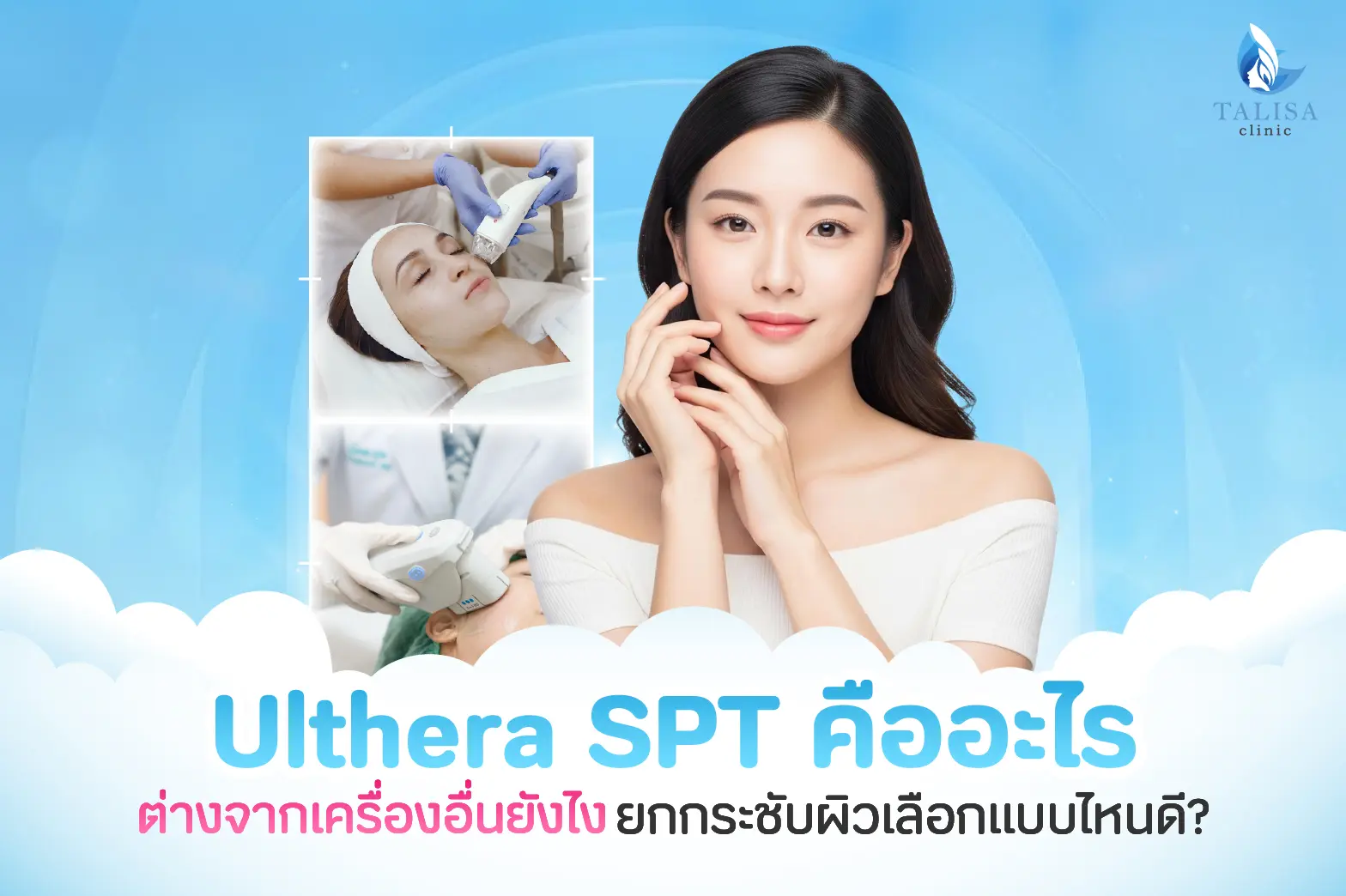 Ulthera SPT คือ