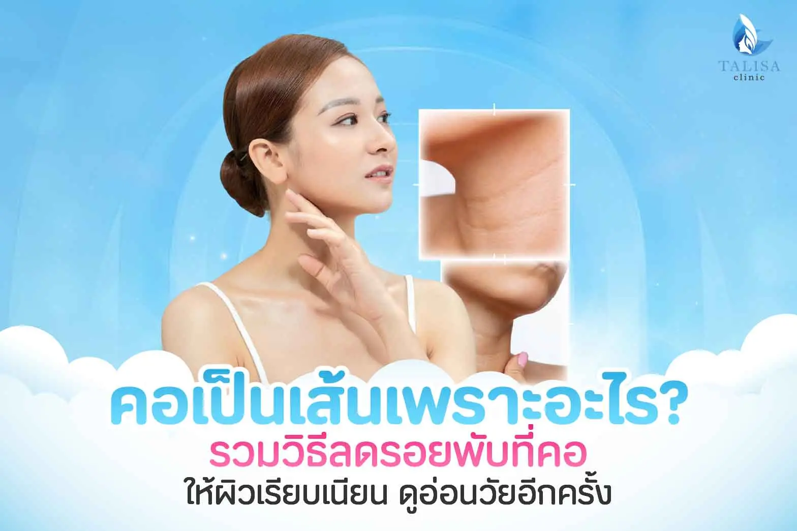 คอเป็นเส้น