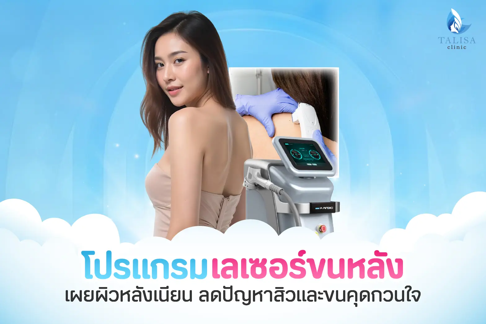 เลเซอร์ขนหลัง