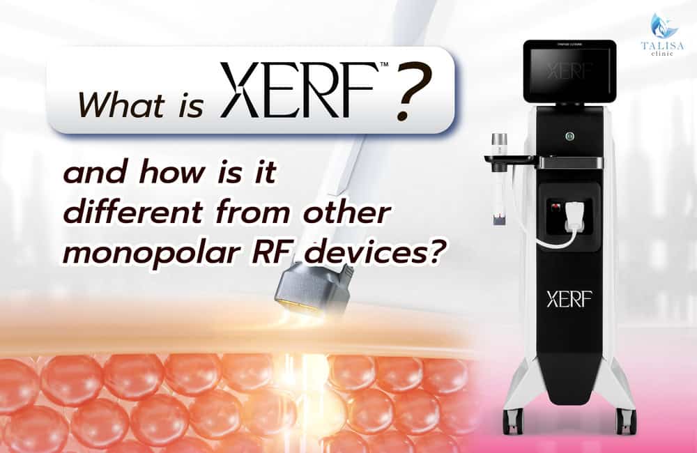 How RF skin tightening in Bangkok works, heating deeper layers to firm facial skin