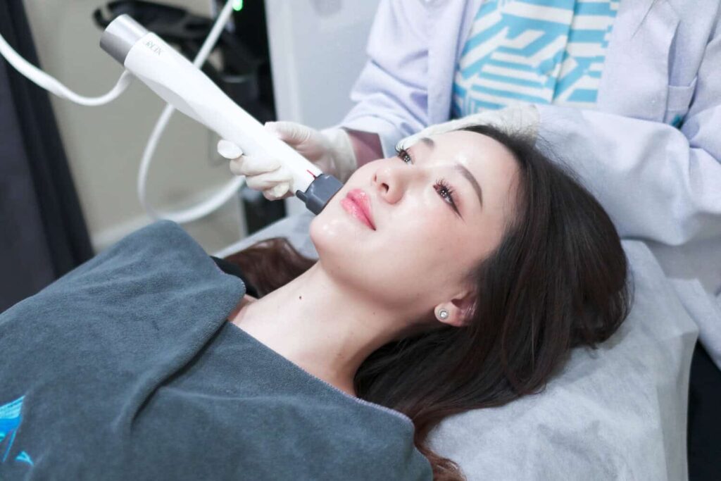 Woman with firmer skin and a defined jawline after XERF RF treatment at TALISA Clinic