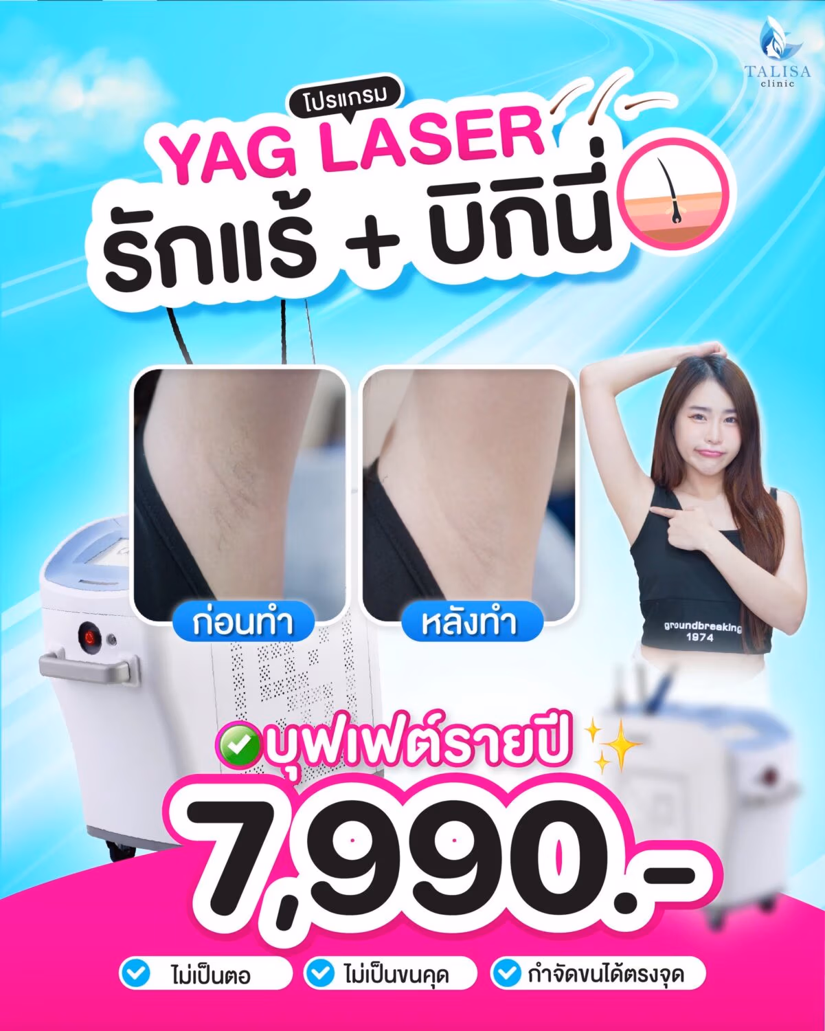 YAG Laser underarm and bikini hair removal annual buffet promotion for ฿7,990 at Talisa Clinic.