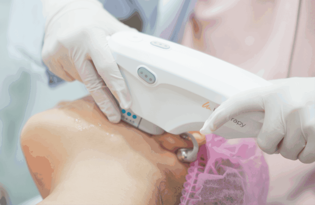 Woman is doing Ultherapy Prime